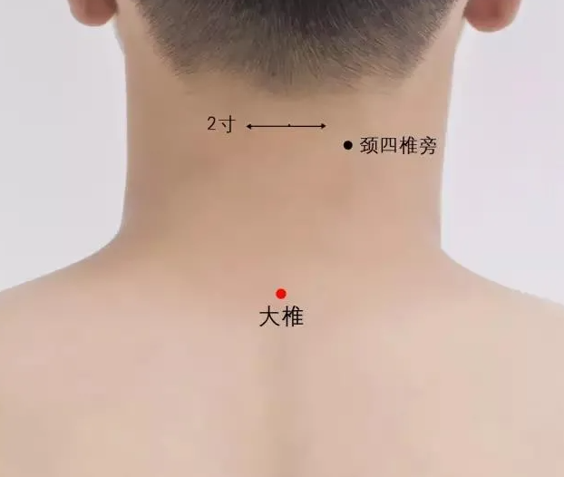 大椎.png